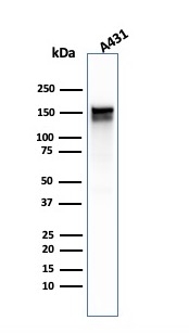 EGFR antibody [GFR/1667]