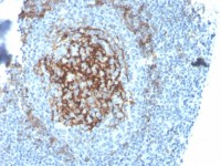 CD23 antibody [FCER2/4395R]