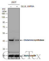 Glutamine synthetase antibody