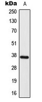 ELOVL4 antibody