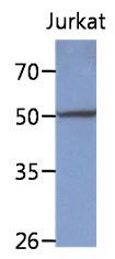 PPM1F antibody [AT6D11]