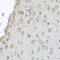 Hemoglobin alpha 2 antibody