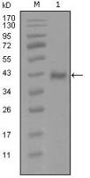 Androgen Receptor antibody [1A9D12]