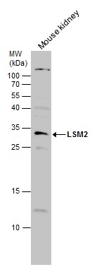 LSM2 antibody