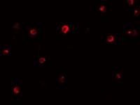 IRF4 / MUM1 antibody