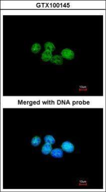 ERCC8 antibody [N2C2], Internal