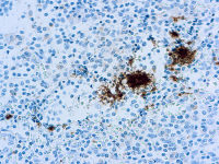 Integrin beta 3 antibody [Y2/51]