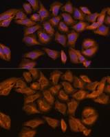 Ribonuclease Inhibitor antibody