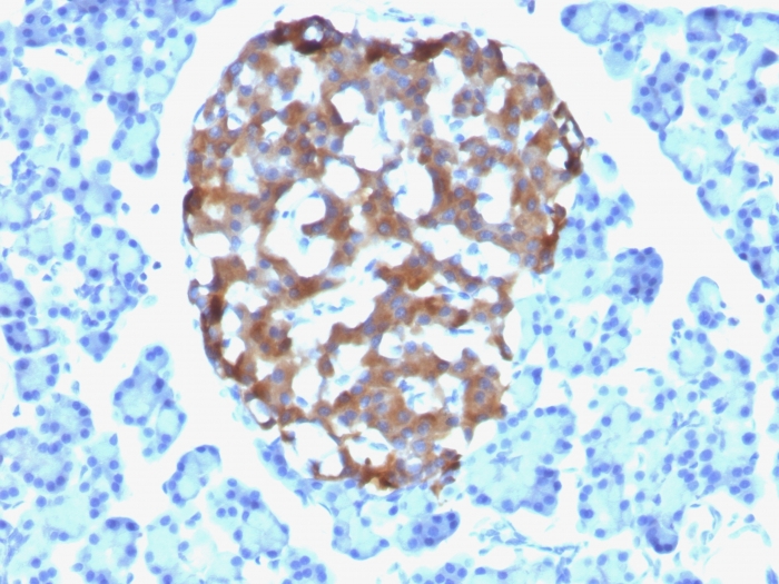 Chromogranin A antibody [CHGA/765]