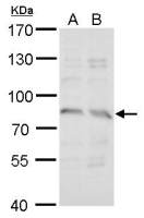 Syntrophin gamma 2 antibody