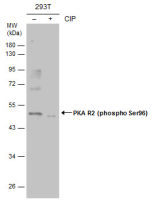 PKA R2 (phospho Ser96) antibody