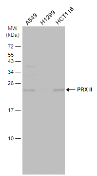 PRX II antibody