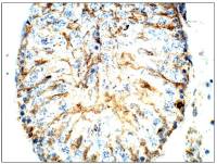 CD317 antibody (C-terminal)