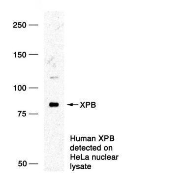XPB antibody