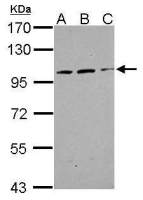 TRAK2 antibody [N1N2], N-term