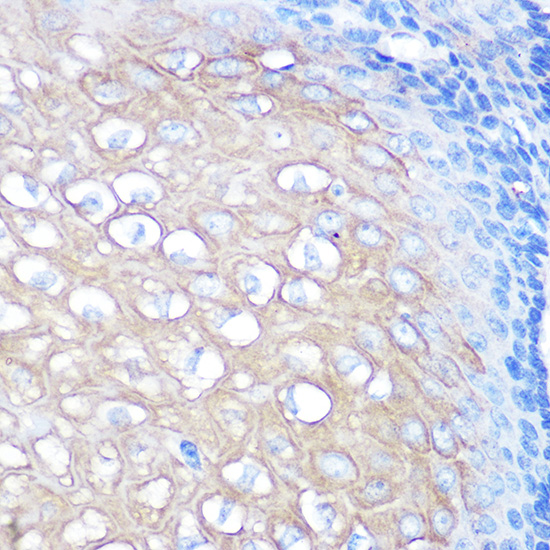 CD168 / RHAMM antibody [GT1346]