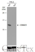 S100A11 antibody