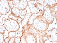 Aurora B antibody [rAURKB/1592]