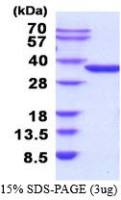 Human NMNAT1 protein, His tag (active)
