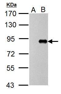 Influenza A virus PB1 protein antibody