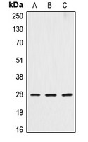Cathepsin D Heavy chain antibody