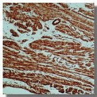 alpha Smooth Muscle Actin antibody [0.N.5]