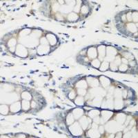 Troponin C fast skeletal antibody