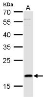 TSLP antibody