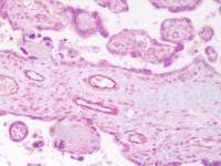 Angiopoietin 2 antibody