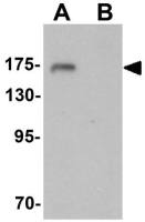 SHANK3 antibody