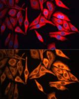 Cytokeratin 8 antibody