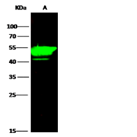 Cytokeratin 14 antibody [101]