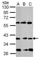 NeuroD1 antibody
