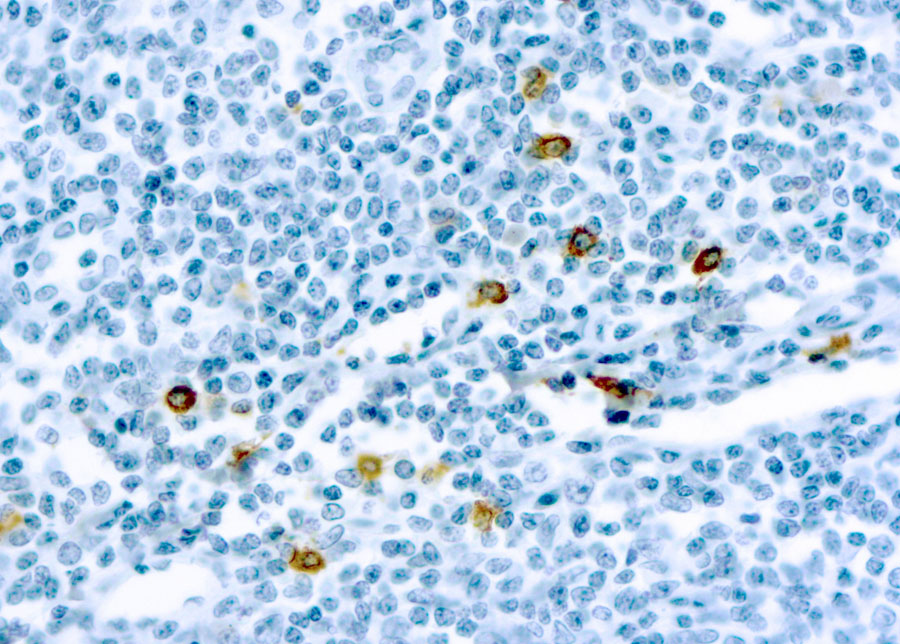 Mast cell chymase antibody [CC1]