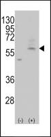 SLC29A4 antibody, C-term