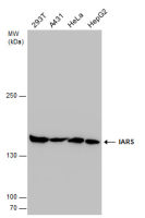 IARS antibody