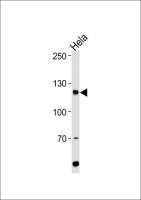 HIRA antibody, Internal