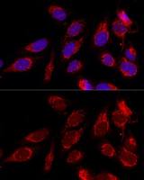 ATAD3B antibody