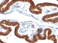 EpCAM antibody [SPM134]