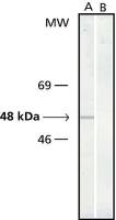 gamma Tubulin antibody [GTU-88]