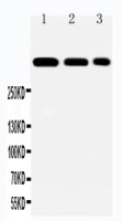 Laminin alpha 2 antibody