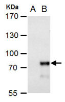 MBD4 antibody