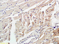 4 Hydroxynonenal antibody