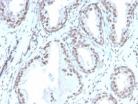 ATRX antibody [rATRX/3446]