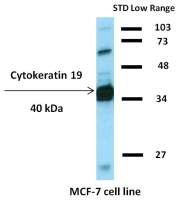Cytokeratin 19 antibody [BA-17] (Biotin)