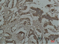 HSP27 antibody [Mix-mA]