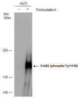 Her2 / ErbB2 (phospho Tyr1139) antibody