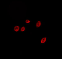 SENP2 antibody