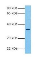 LECT1 antibody, N-term