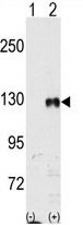 EphB1 antibody